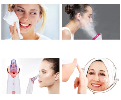 CleanPro Blackhead Remover